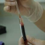 L'analyse du sang pour diagnostiquer le cancer