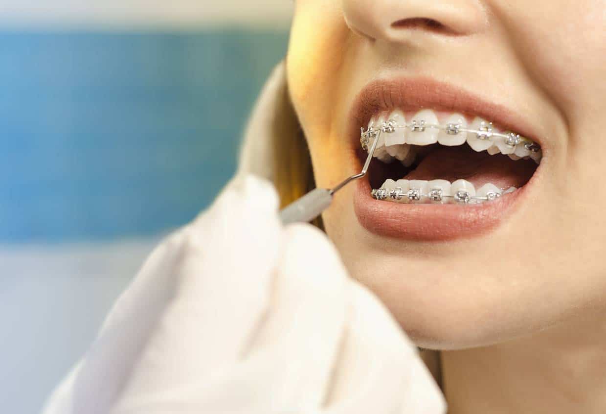 L'orthodontie